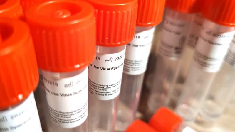 NRW-Ministerpräsident will Gratis-Tests für Geimpfte und Genesene