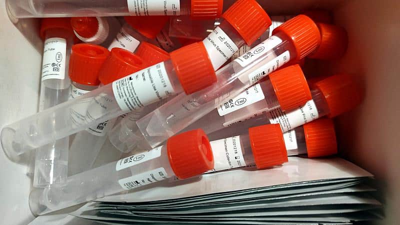 Virologen sehen Mängel bei Corona-Testzentren in NRW